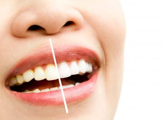 Relação perigosa: álcool e saúde bucal