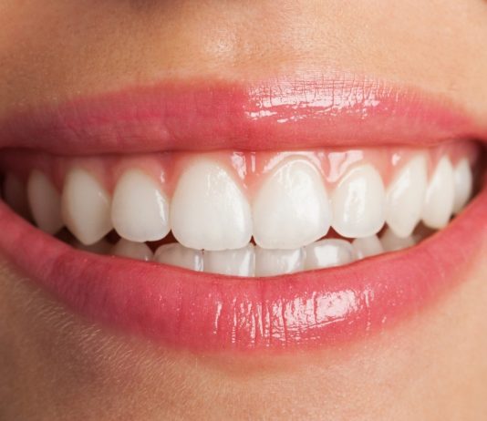 Festa junina: comidas típicas requerem atenção para os cuidados dos dentes