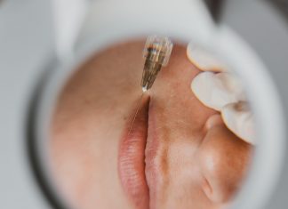 Especialista alerta para riscos da harmonização facial com PMMA