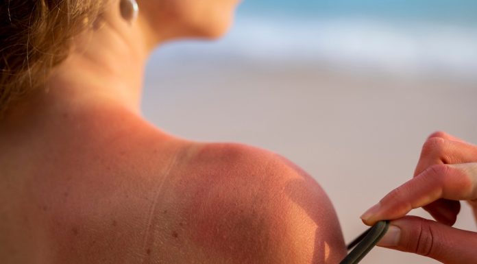 Pesquisa revela como o sol mata células e envelhece a pele