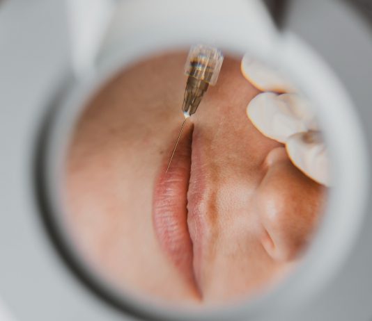 Especialista alerta para riscos da harmonização facial com PMMA