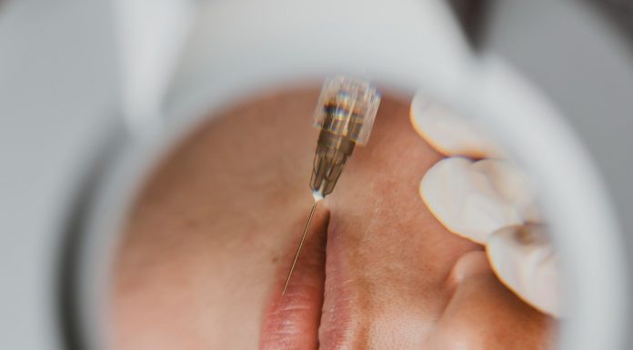 Especialista alerta para riscos da harmonização facial com PMMA