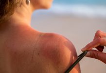 Pesquisa revela como o sol mata células e envelhece a pele