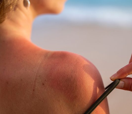 Pesquisa revela como o sol mata células e envelhece a pele